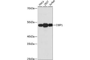 Western blot analysis of extracts of various cell lines, using CtBP1 Rabbit mAb (ABIN7265976) at 1:1000 dilution. (CTBP1 antibody)