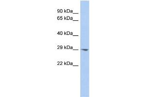 WB Suggested Anti-ECHDC2 Antibody Titration:  0. (ECHDC2 antibody  (Middle Region))