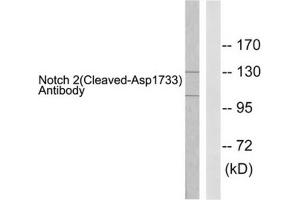 Western blot analysis of extracts from 293 cells treated with TNF-a (20ng/ml, 30mins), using Notch 2 (cleaved-Asp1733) antibody.