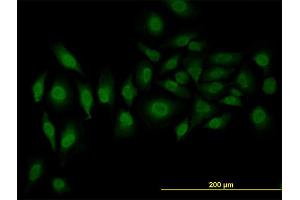 Immunofluorescence of monoclonal antibody to SFRS3 on HeLa cell.