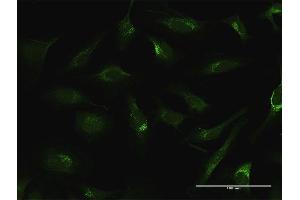 Immunofluorescence of purified MaxPab antibody to FTL on HeLa cell. (FTL antibody  (AA 1-175))