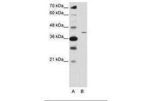 Image no. 1 for anti-Zinc Finger Protein 488 (ZNF488) (N-Term) antibody (ABIN6736221)