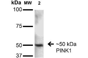 Western Blot analysis of Rat Brain showing detection of ~50 kDa PINK1 protein using Mouse Anti-PINK1 Monoclonal Antibody, Clone S4-15 .