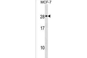 NKAI4 Antibody (C-term) (ABIN1536774 and ABIN2849663) western blot analysis in MCF-7 cell line lysates (35 μg/lane). (NKAIN4 antibody  (C-Term))