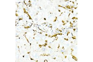 Immunohistochemistry of paraffin-embedded Human liver using GST3/GSTP1 antibody (ABIN7267448) at dilution of 1:100 (40x lens). (GSTP1 antibody)