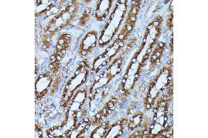 Immunohistochemistry of paraffin-embedded mouse kidney using FGD1 antibody (ABIN7267284) at dilution of 1:100 (40x lens).