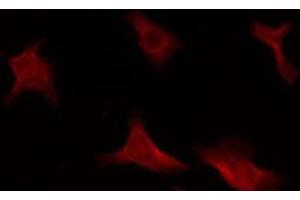 ABIN6266609 staining HeLa by IF/ICC. (CDKN2B antibody  (Internal Region))