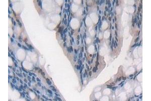 Immunohistochemistry (IHC) image for anti-Glutathione Reductase (GSR) (AA 240-500) antibody (ABIN7442147)