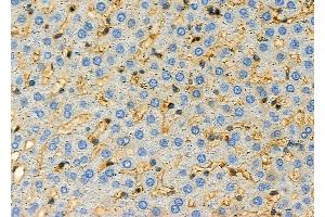 ABIN6257071 and ABIN6274969 at 1/100 staining Rat liver tissue by IHC-P.