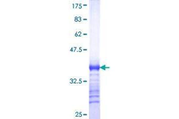 RHCG Protein (AA 418-479) (GST tag)