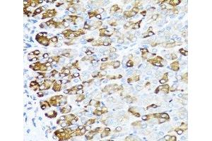 Immunohistochemistry of paraffin-embedded Mouse stomach using MGP Polyclonal Antibody at dilution of 1:100 (40x lens).