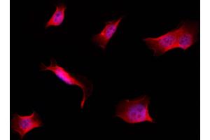 ABIN6257584 and ABIN6274265 staining Hela by IF/ICC.
