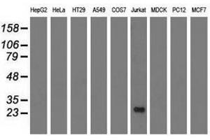 Image no. 2 for anti-Ras-Like Without CAAX 2 (RIT2) antibody (ABIN1500713)