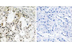 Peptide - + (EIF3D antibody  (Internal Region))