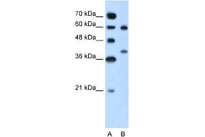 WB Suggested Anti-ARG1 Antibody Titration:  5. (Liver Arginase antibody  (N-Term))