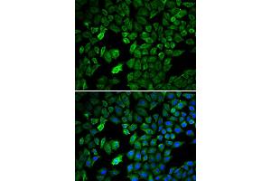Immunofluorescence analysis of U2OS cell using PRMT5 antibody. (PRMT5 antibody)