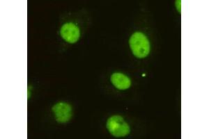 Immunocytochemistry of HeLa cells using anti-DBC1 mouse mAb diluted 1:200. (DBC1 antibody)