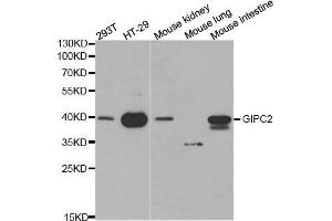 Western blot analysis of extracts of various cell lines, using GIPC2 antibody. (GIPC2 antibody  (AA 1-315))