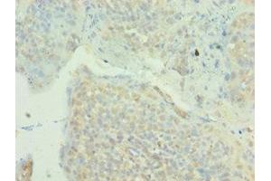 Immunohistochemistry of paraffin-embedded human tonsil tissue using ABIN7160003 at dilution of 1:100 (MAPK4 antibody  (AA 348-587))
