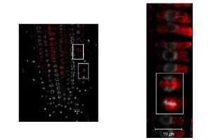 Immunohistochemistry (IHC) image for anti-Tubulin alpha Chain (TUB1) antibody (ABIN7477855) (Tubulin alpha Chain (TUB1) antibody)