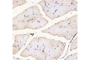 Immunohistochemistry of paraffin embedded rat skeletal muscle using Palladin (ABIN7074976) at dilution of 1: 1000 (250x lens)