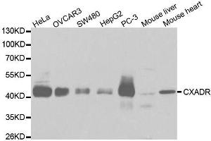 Western blot analysis of extracts of various cell lines, using CXADR antibody. (Coxsackie Adenovirus Receptor antibody  (AA 20-237))