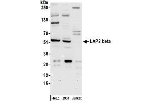 Western Blotting (WB) image for anti-LAP2 beta/tmpo (AA 300-350) antibody (ABIN7455056) (LAP2 beta/tmpo (AA 300-350) antibody)