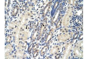 EIF4E2 antibody was used for immunohistochemistry at a concentration of 4-8 ug/ml to stain Epithelial cells of renal tubule (arrows) in Human Kidney.