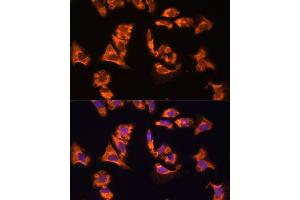 Immunofluorescence analysis of mouse heart using OBSCN antibody (ABIN7269076) at dilution of 1:100. (Obscurin antibody)