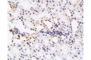 Formalin-fixed and paraffin embedded rat kidney tissue labeled with Anti-HGF Polyclonal Antibody, Unconjugated at 1:200, followed by conjugation to the secondary antibody and DAB staining (HGF antibody  (AA 201-300))