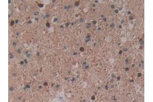 Immunohistochemistry (IHC) image for anti-Coagulation Factor XIII, A1 Polypeptide (F13A1) (AA 107-345) antibody (ABIN7433159)
