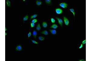 Immunofluorescence staining of A549 cells with ABIN7151424 at 1:166, counter-stained with DAPI. (EFHD1 antibody  (AA 15-72))