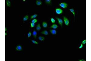 Immunofluorescence staining of A549 cells with ABIN7151424 at 1:166, counter-stained with DAPI.
