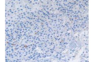 IHC-P analysis of Rat Adrenal Gland Tissue, with DAB staining.