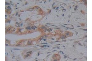 Immunohistochemistry (IHC) image for anti-Lysine (K)-Specific Demethylase 4A (KDM4A) (AA 141-310) antibody (ABIN7441397)