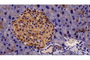 Detection of CBX3 in Mouse Pancreas Tissue using Polyclonal Antibody to Chromobox Homolog 3 (CBX3) (CBX3 antibody  (AA 1-183))