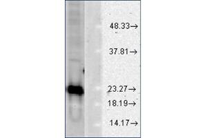 Image no. 2 for anti-Superoxide Dismutase 1, Soluble (SOD1) antibody (ABIN264856) (SOD1 antibody)