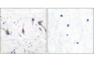 Immunohistochemistry analysis of paraffin-embedded human brain tissue, using ARC Antibody. (ARC (AA 159-208) antibody)
