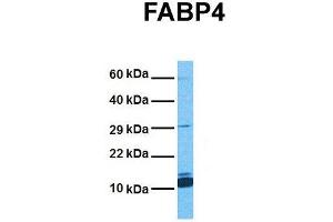 Host:  Rabbit  Target Name:  FABP4  Sample Tissue:  Human Stomach Tumor  Antibody Dilution:  1. (FABP4 antibody  (Middle Region))