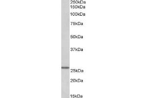 ABIN1590104 (0. (LAT2 antibody  (Internal Region))