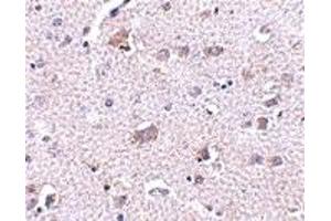 Immunohistochemistry (IHC) image for anti-Cerebral Dopamine Neurotrophic Factor (CDNF) (C-Term) antibody (ABIN1030330) (CDNF antibody  (C-Term))