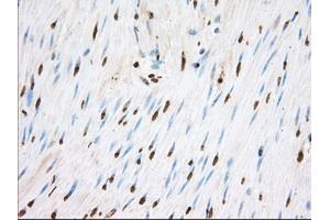 Image no. 1 for anti-Transforming, Acidic Coiled-Coil Containing Protein 3 (TACC3) antibody (ABIN1498097) (TACC3 antibody)