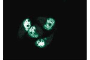 Immunofluorescence staining of AN3 CA cells (Human endometrial adenocarcinoma, ATCC HTB-111). (PCNA antibody  (AA 68-230))