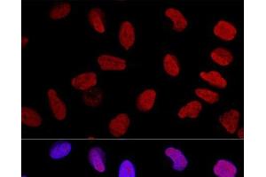 Confocal immunofluorescence analysis of U2OS cells using KU70 Polyclonal Antibody at dilution of 1:100. (XRCC6 antibody)