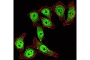 Immunofluorescence analysis of Eca-109 cells using KLF4 monoclonal antibody, clone 1E6  (green) . (KLF4 antibody)