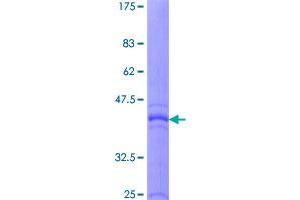 Image no. 1 for Interleukin 5 (IL5) (AA 1-134) protein (GST tag) (ABIN1307830) (IL-5 Protein (AA 1-134) (GST tag))