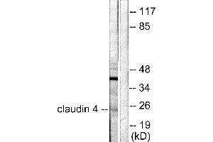 Western blot analysis of extracts from HeLa cells, using Claudin 4 antibody (#C0141). (Claudin 4 antibody)