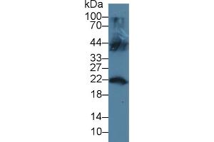 Detection of LCN12 in Mouse Testis lysate using Polyclonal Antibody to Lipocalin 12 (LCN12) (LCN12 antibody  (AA 61-184))
