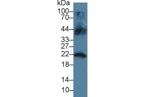 LCN12 抗体  (AA 61-184)