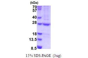 N-6 Adenine-Specific DNA Methyltransferase 1 (Putative) (N6AMT1) (AA 1-214) protein (His tag)